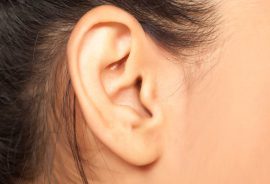Chirurgie des oreilles décollées par Earfold