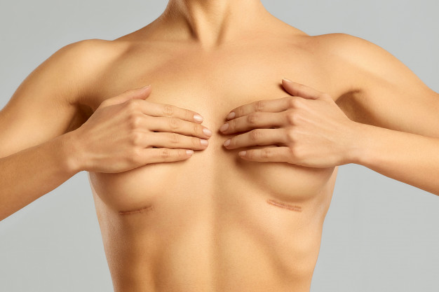 Les cicatrices post-chirurgie : quelles solutions pour les ...